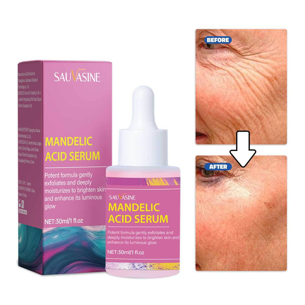 30ml Glycolic Acid Serum Facial